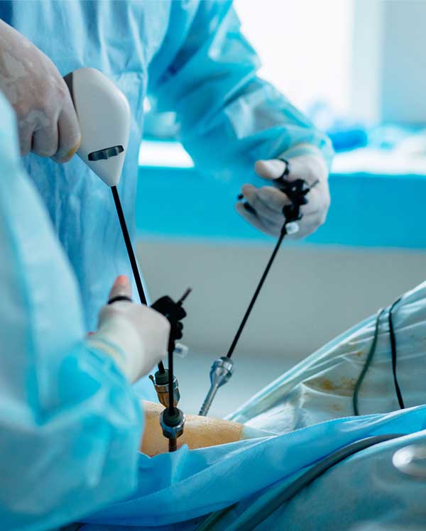 Laparoscopic Surgery