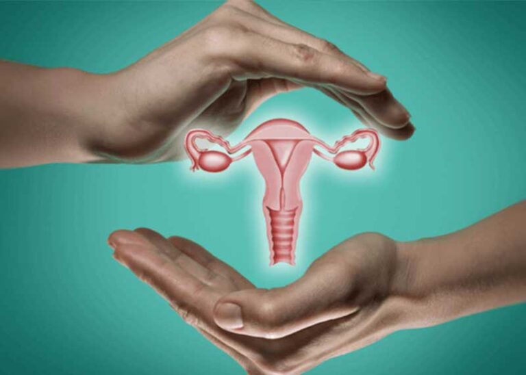 Hysterectomy